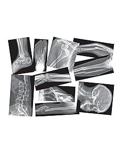 Roylco  True To Life Human X-Rays, 18pk of reproducible worksheets and guide. R5911