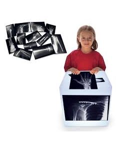 Fixed Bones X-Rays, 28 pcs. Authentic images to fix a broken bone. R59255